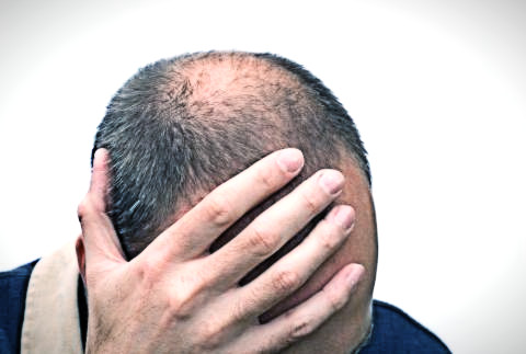 Metodi di prevenzione di perdita dei capelli